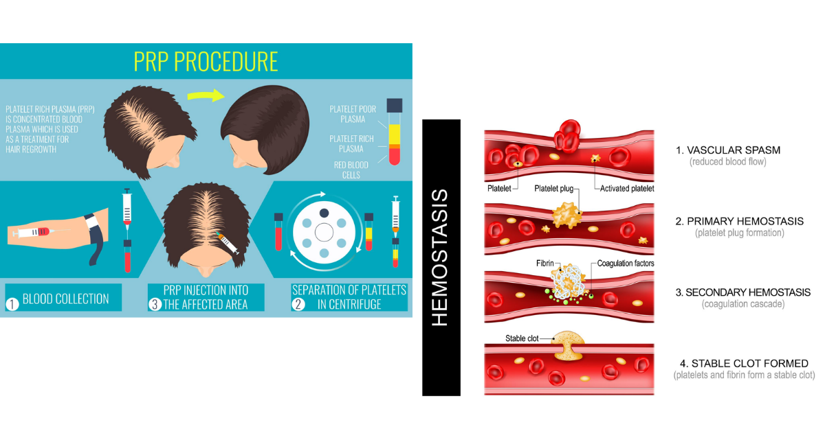 Platelets Beyond Clotting The New Frontier in Regenerative Medicine