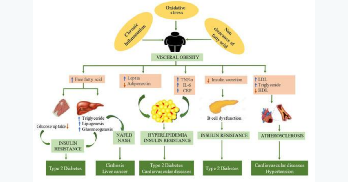 viscral obesity